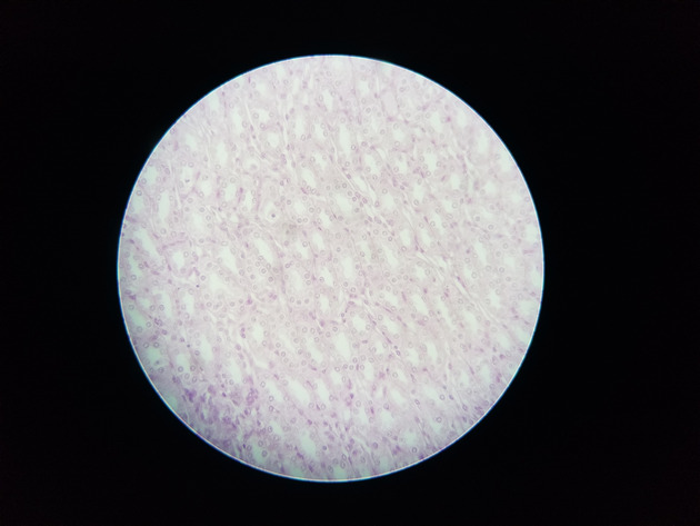 Simple Cuboidal Epithelium Slides - Simple Cuboidal Epithelium 01 400X